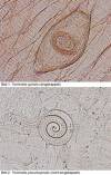 trichinella_spiralis.jpg